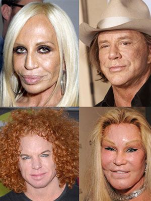 bad plastic surgery.jpg
